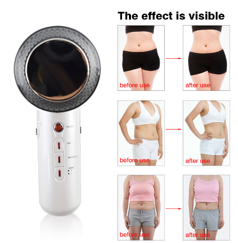 Handheld Ultrasound Body Fat Remove Massager